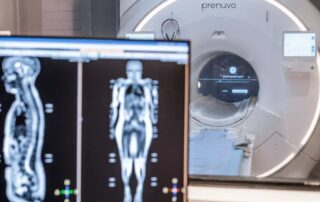 MRI machine with body scan images displayed on a monitor.